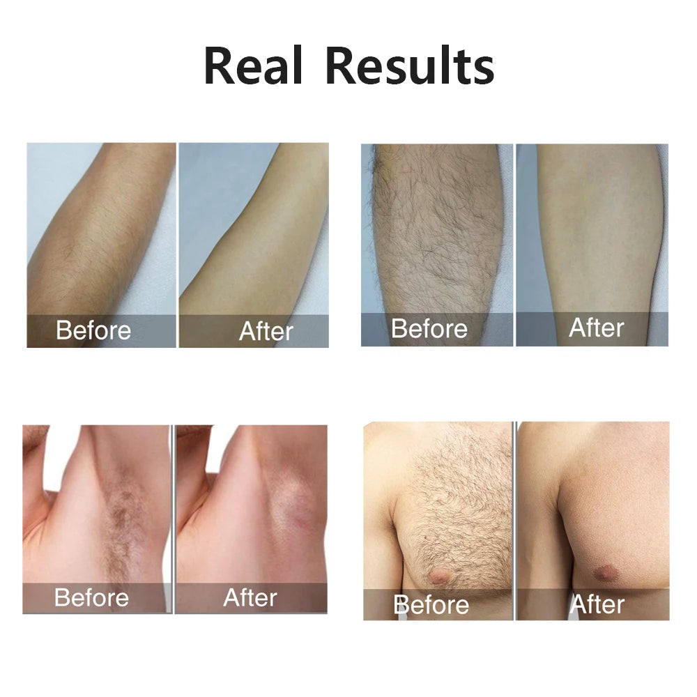 LumaSilk IPL Epilator