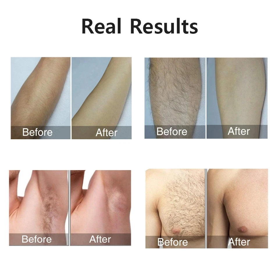 LumaSilk IPL Epilator