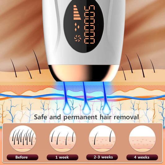 LumaSilk IPL Epilator