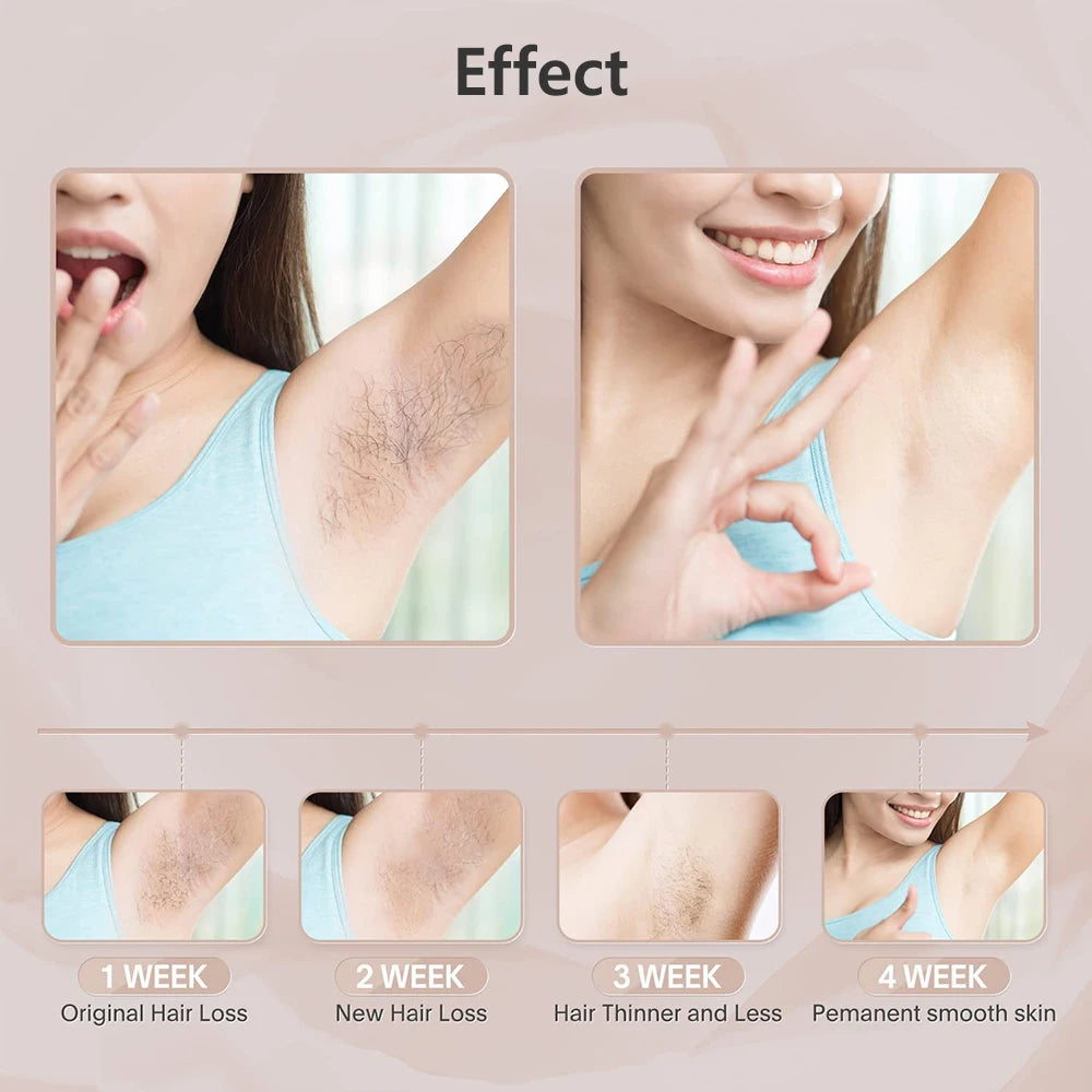 LumaSilk IPL Epilator